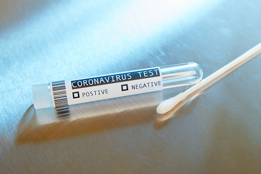 Testing Positive: How to Navigate Covid Diagnosis as a College Student